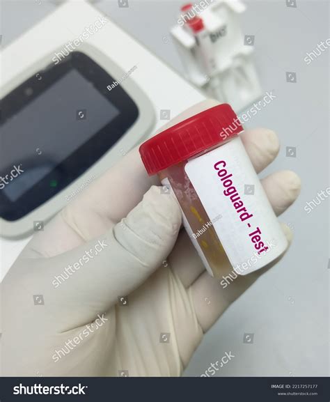 will a soft stool sample affect cologuard test results|cologuard diarrhea samples.